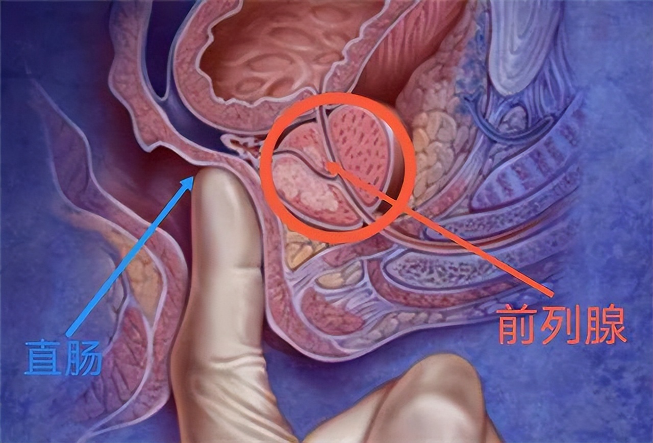 吃生大蒜对前列腺炎有影响吗,大蒜治前列腺功效与作用