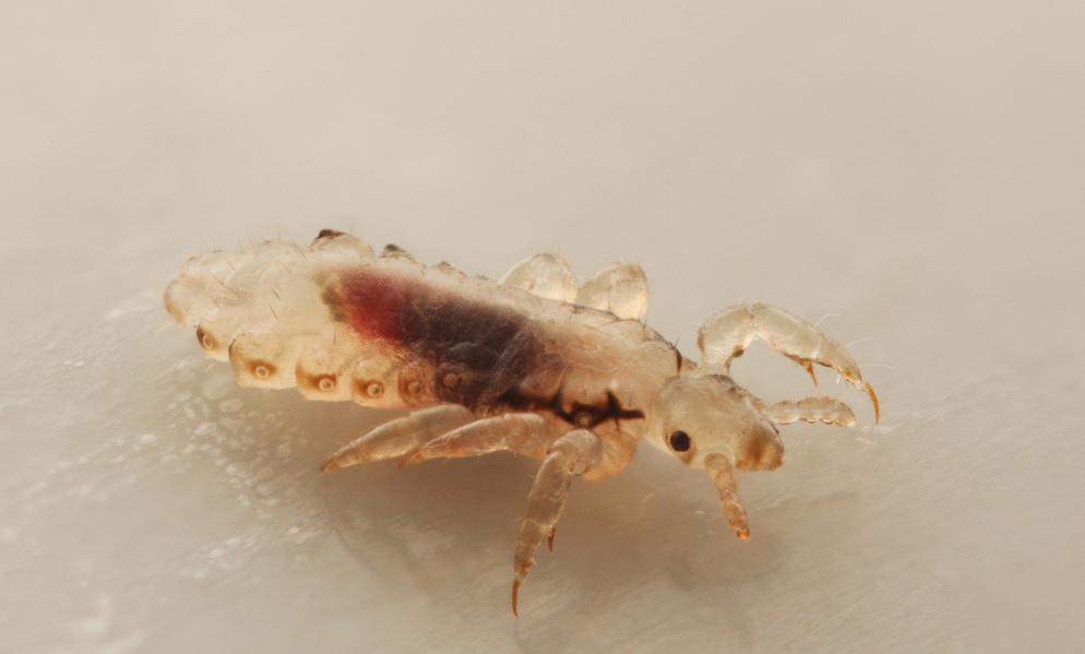 工厂打工爱上了大18岁大叔，确定后次日下身瘙痒难耐，原来是阴虱