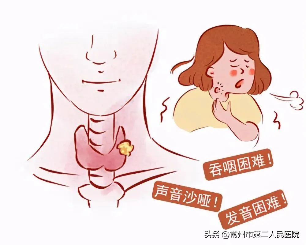 炎热时甲状腺素分泌会减少吗,容易中暑跟甲状腺有关系吗