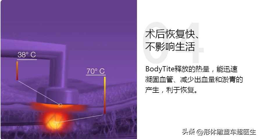 脸部激光溶脂后有疙瘩吗,脸部激光手术后皮肤松弛