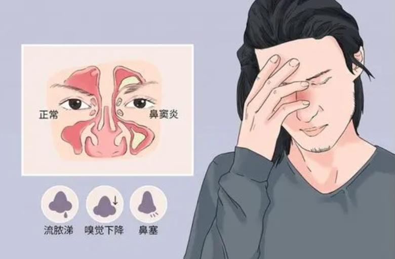 阿莫西林都是消炎药吗,阿莫西林是最好的消炎药了吗