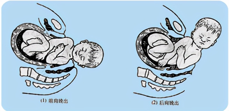 孕妈妈怎么判断胎位是正的,胎儿屁股在右侧是什么胎位