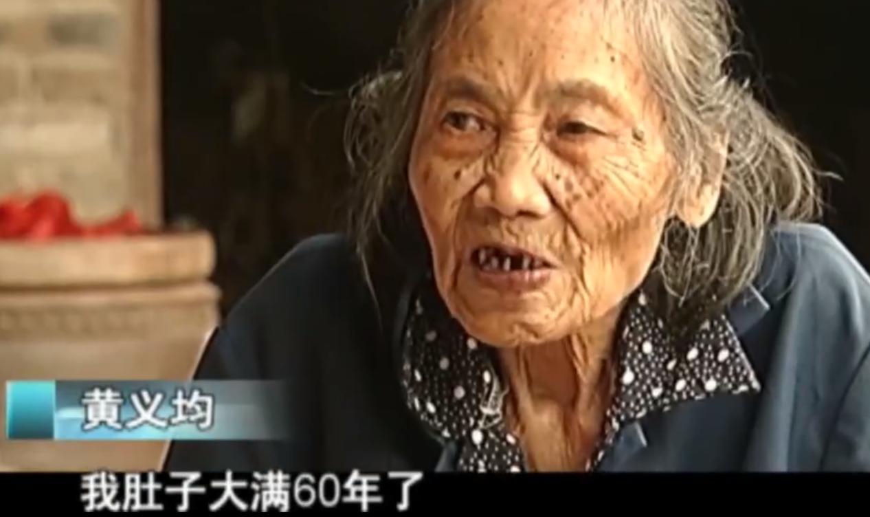 2007年四川90岁老妇，腹中怀子60年未生，后检查发现胎儿没有腐烂