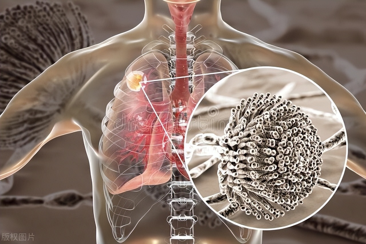 肺部有病警惕喉部六个信号,肺部有这四种表现应该尽快检查