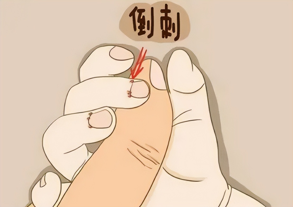 指甲如何看气血不足,怎么通过指甲判断气血不足