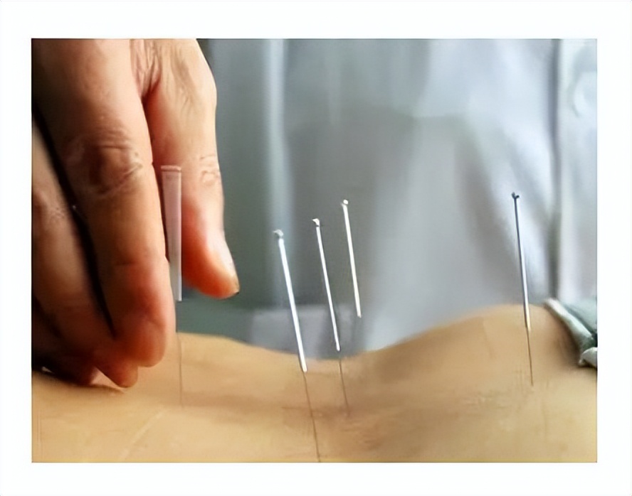 腰痛原因讲解,腰痛康复科普文章内容