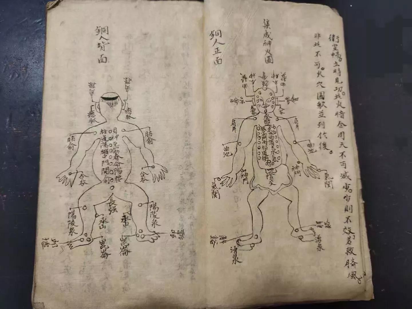 火灸疗法的书,藏医火灸疗法书