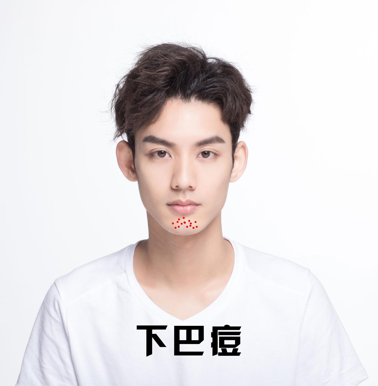 祛痘攻略图文,全网最好用的祛痘方法