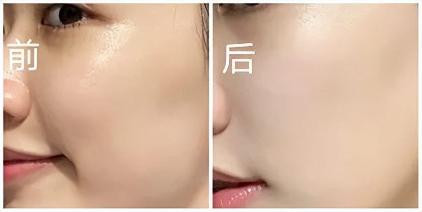 2021美白淡斑面膜十大排行榜口碑,美白祛斑补水保湿面膜测评