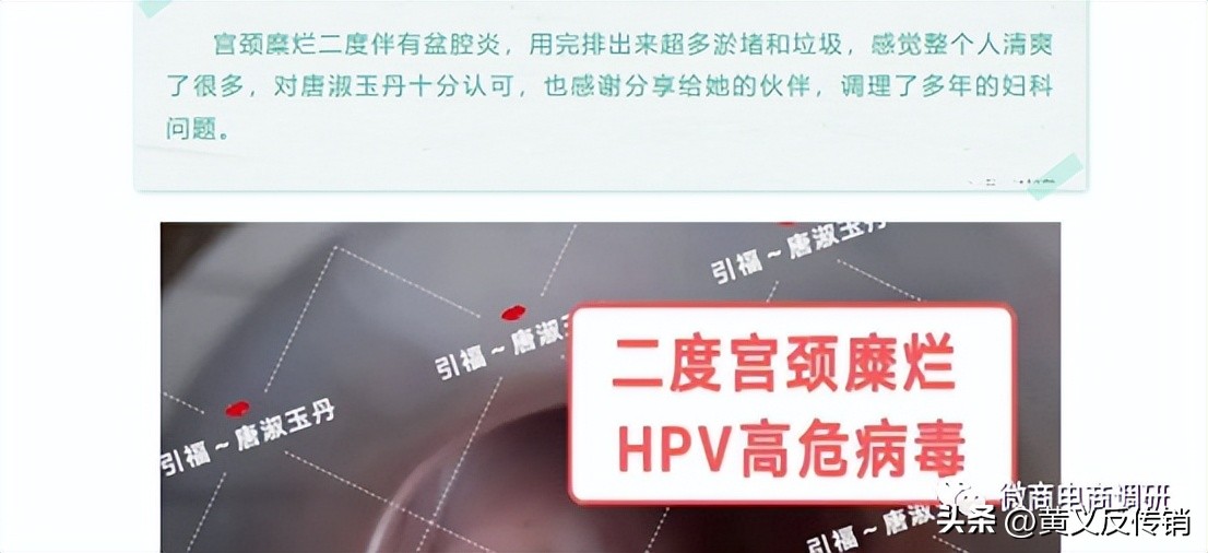 唐淑玉丹：消毒产品自称可以“缩阴”，四级代理模式包含何种奖励