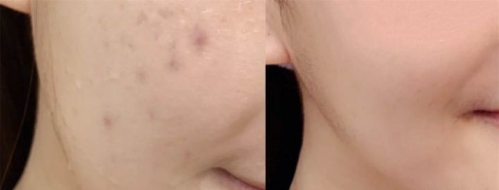 哪家是真正的国货春娟牌黄芪霜,春娟黄芪霜经典国货面霜