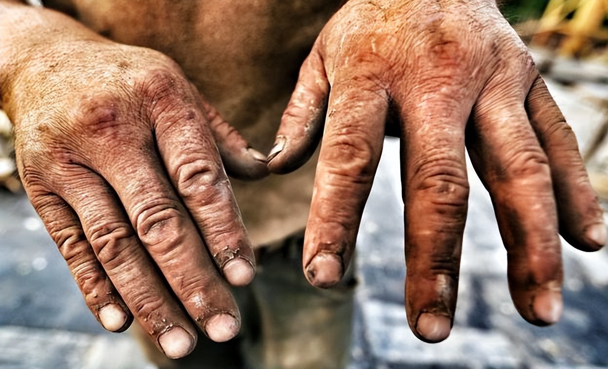 世界杯为什么火爆,世界杯火吗