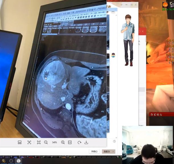 旭旭宝宝下半身肿瘤恶化,旭旭宝宝得了脑瘤