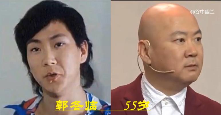 郭冬临头发变化史,郭冬临以前有头发现在光头