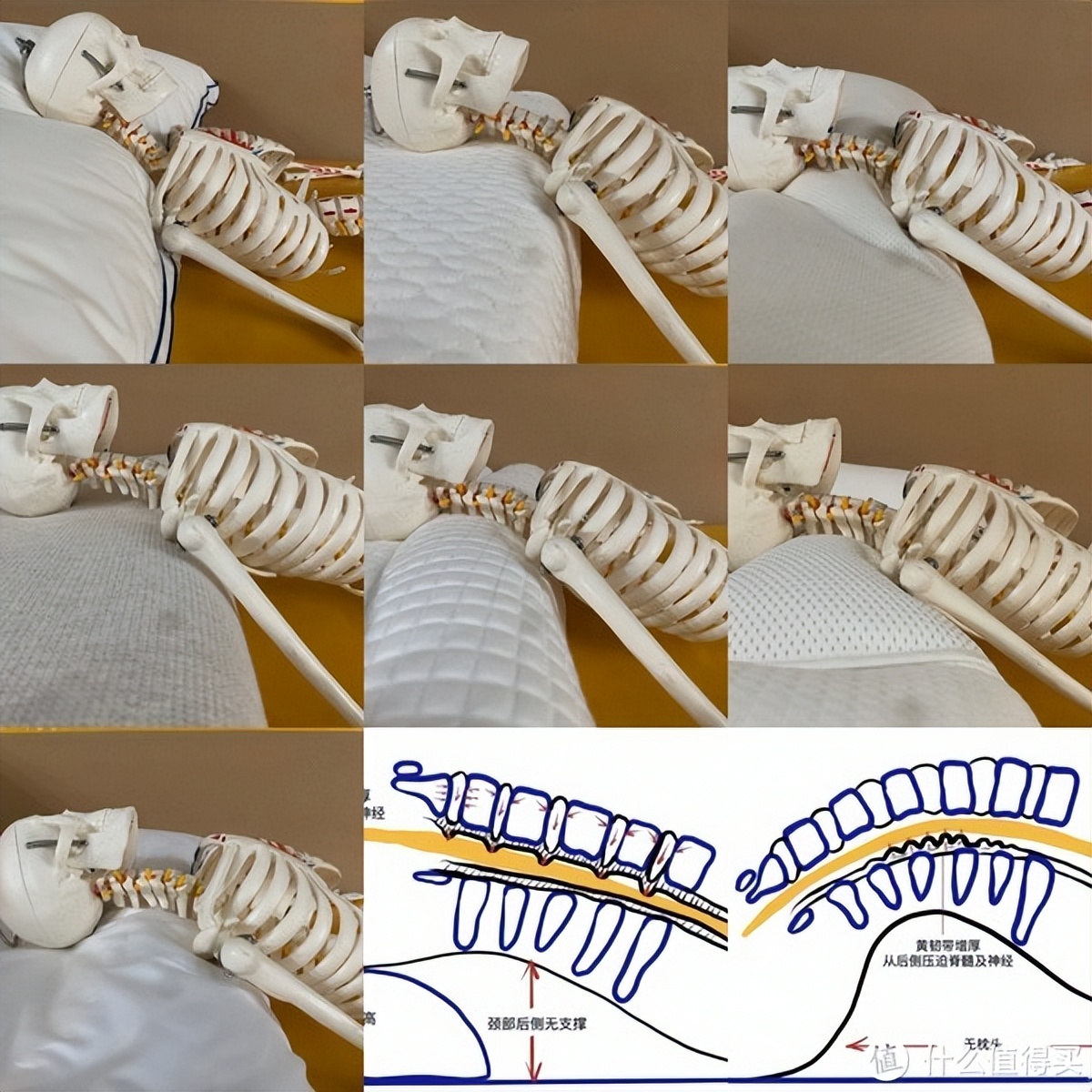 颈椎枕对颈椎病有用吗,记忆枕对颈椎好吗