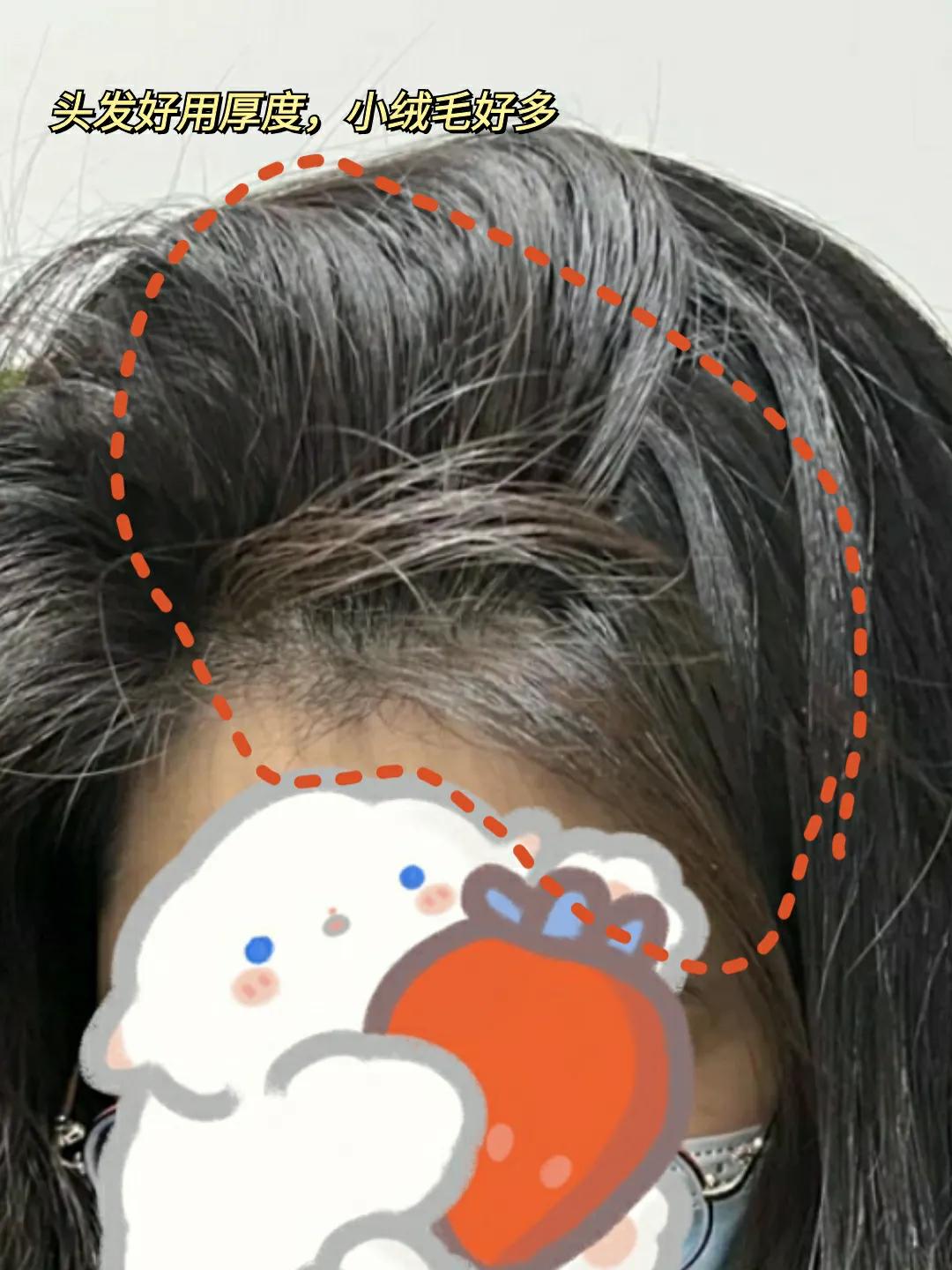 养发真上头，掉发少了，小炸毛多到收不住