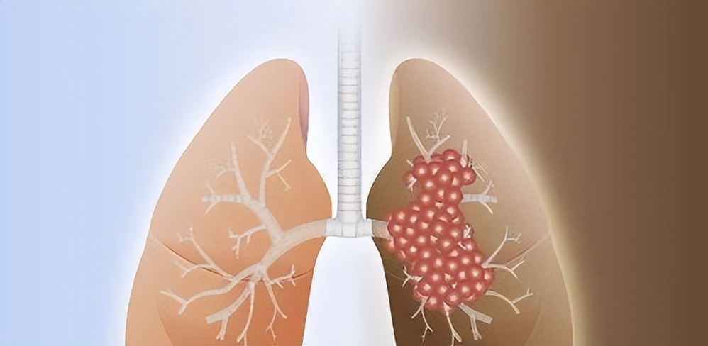 抽烟的危害和戒烟的方法,抽烟上瘾了怎么戒烟
