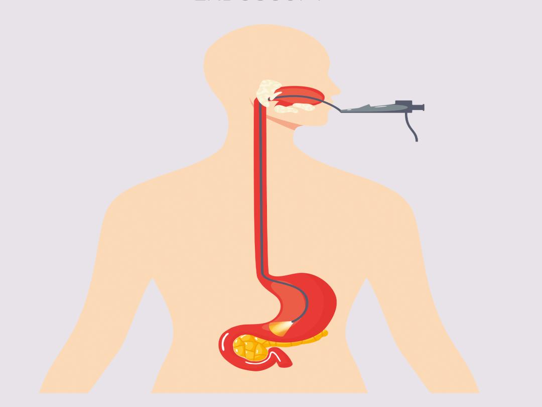 胃镜多久做一次好对胃有伤害吗,做一次胃镜对胃伤害多大