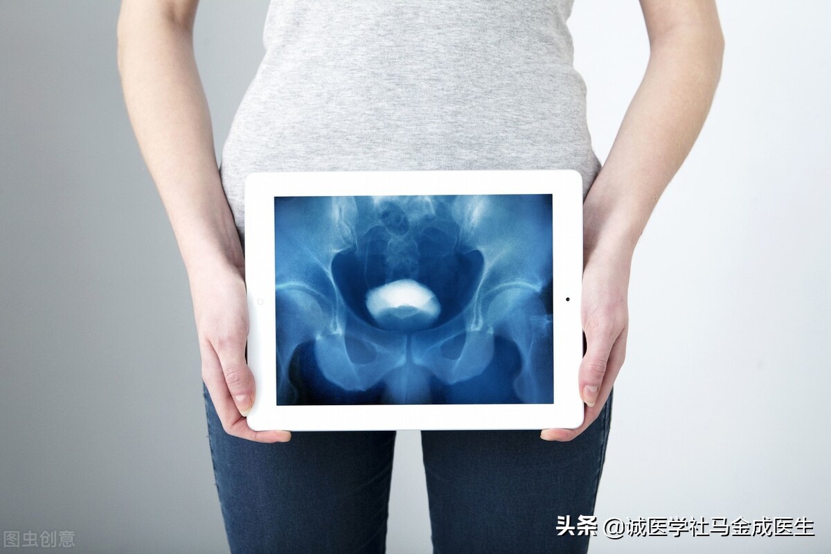 有助于消结石的中药,结石吃什么草药比较容易排出来