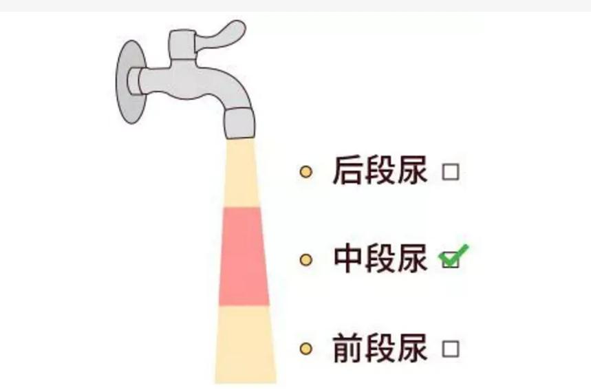 尿标本为何是晨尿,什么时段的尿液标本检查更准确