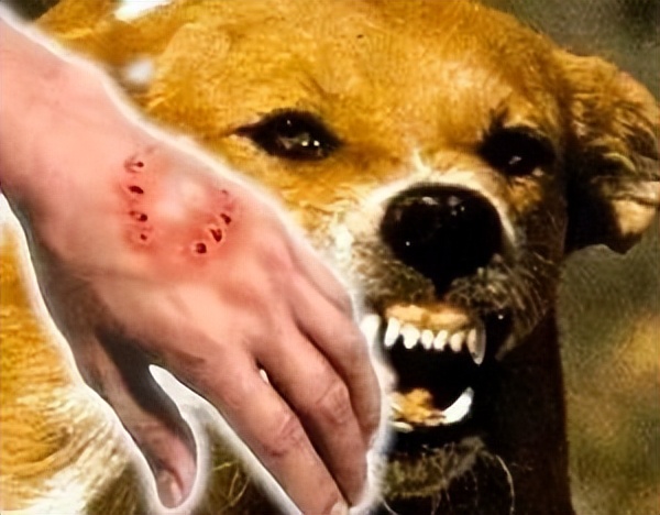 狗狗有哪些表现是精神病,狗狗玩不小心咬到是狂犬病吗