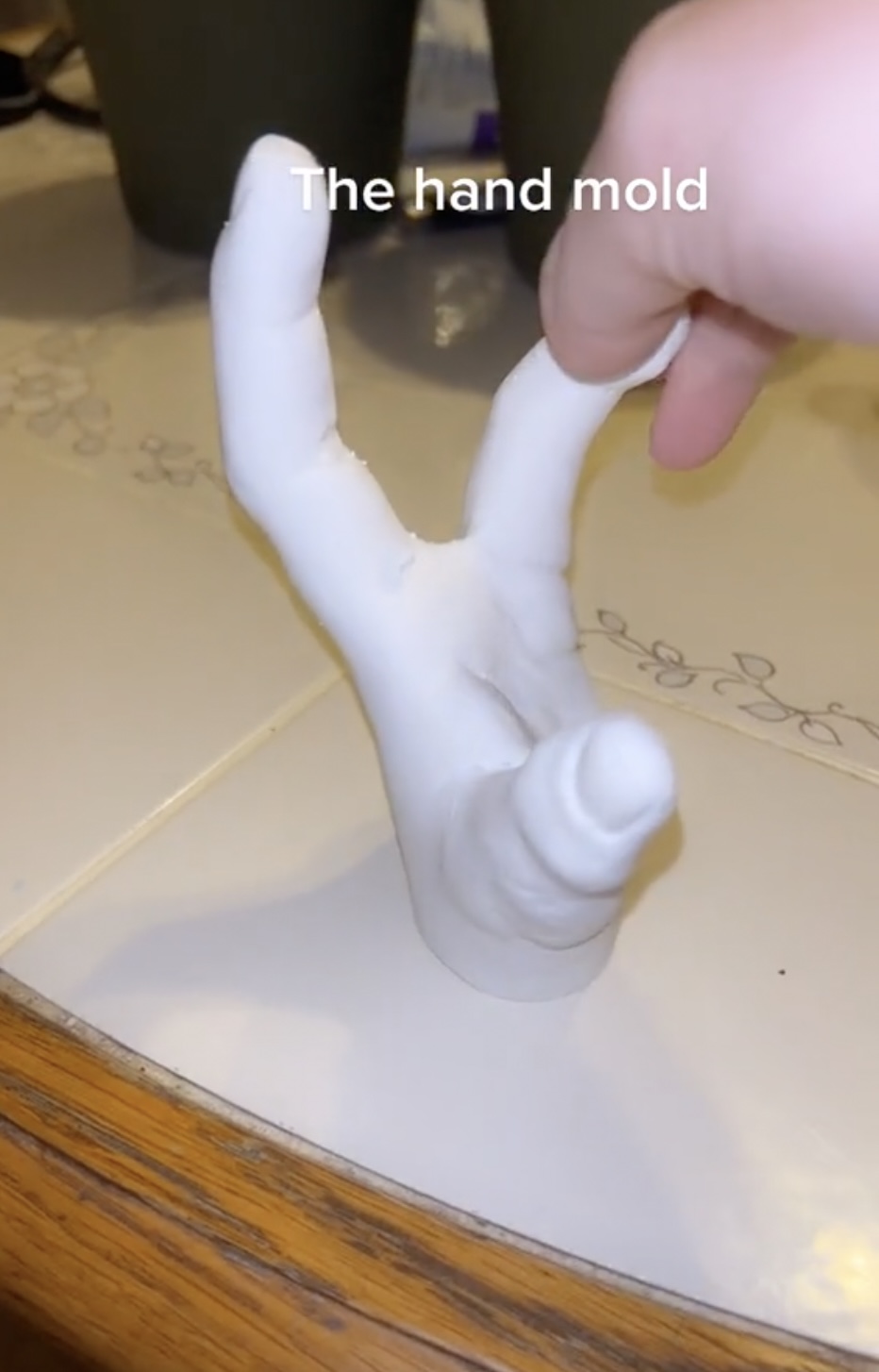 妹子天生只有3根手指，别人说她“霸王龙”，她用乐观狠狠反击！