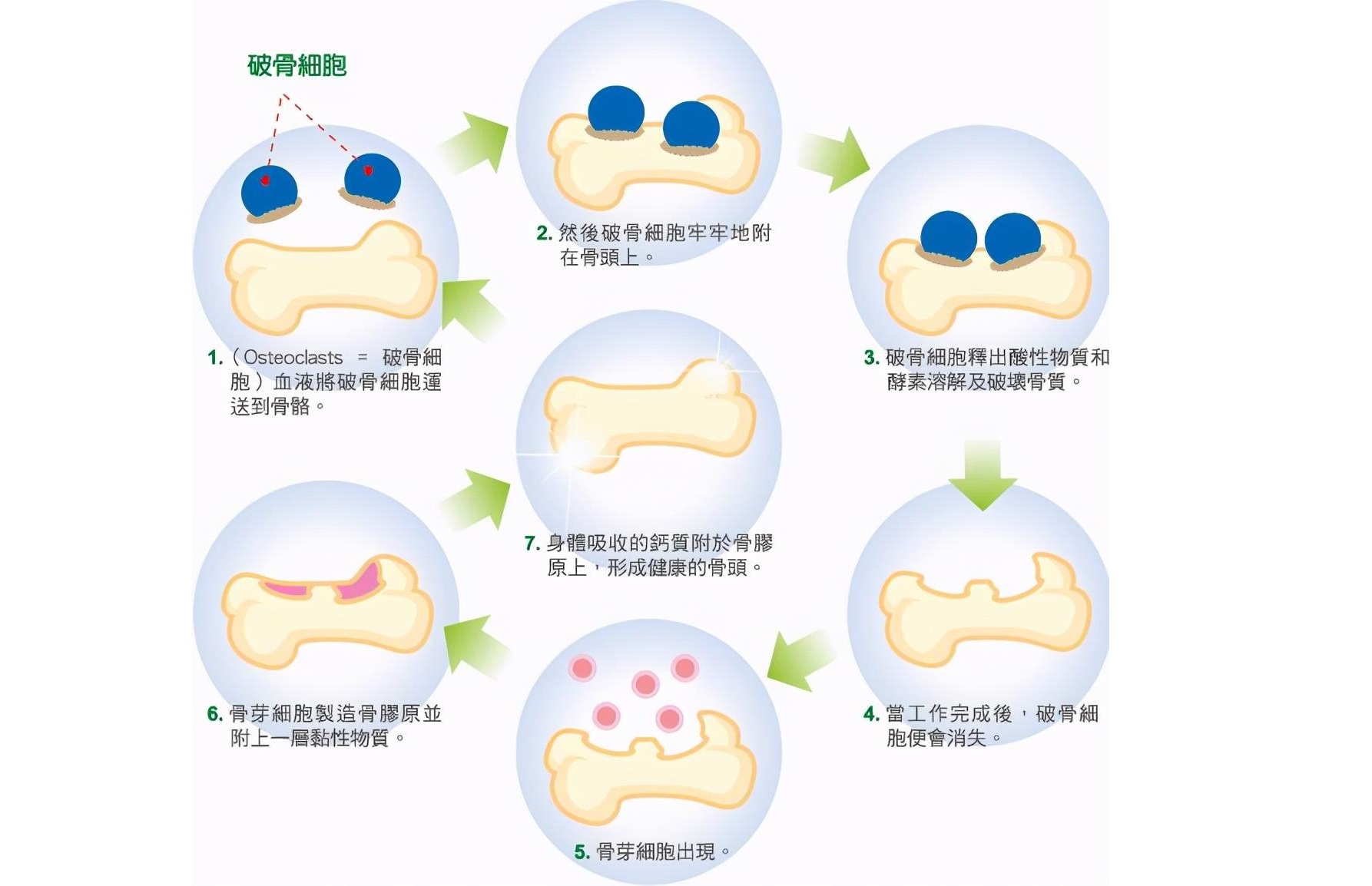 人人都离不开骨骼变老！衰老对骨骼有何影响？医生教你4招应对