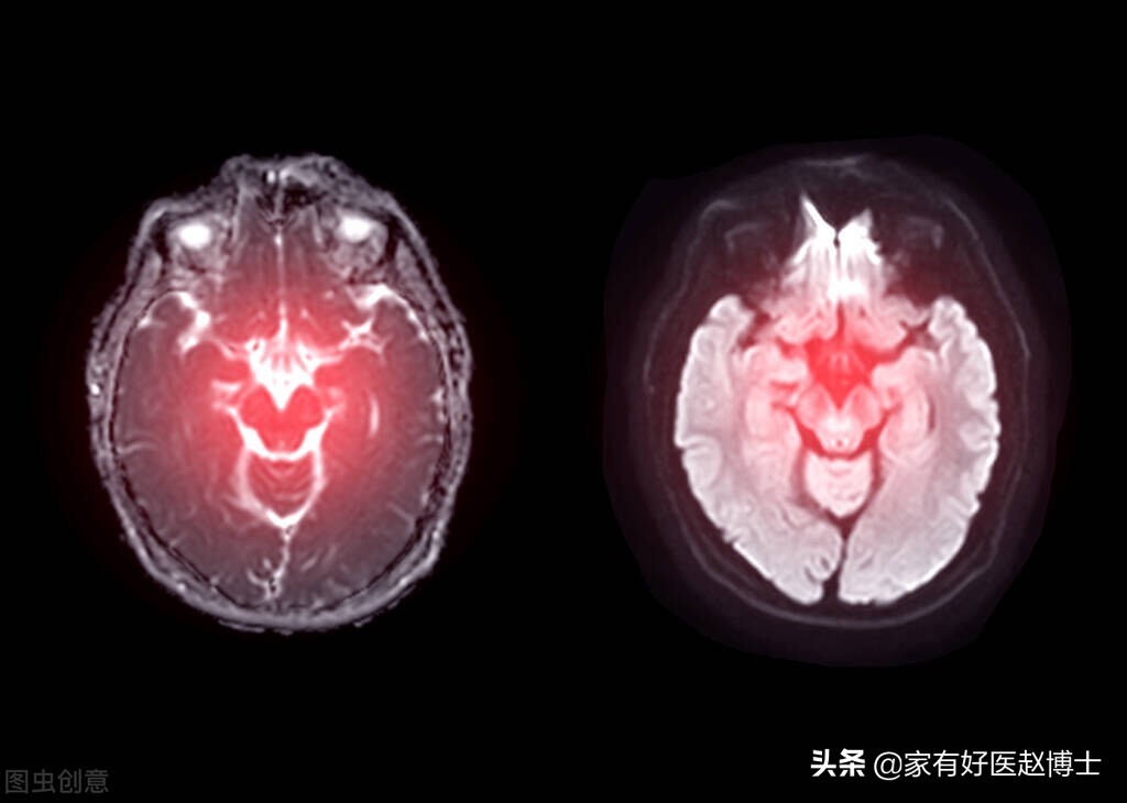 高血压患者血压一阵阵的持续升高,血压忽高忽低怎么判断是高血压