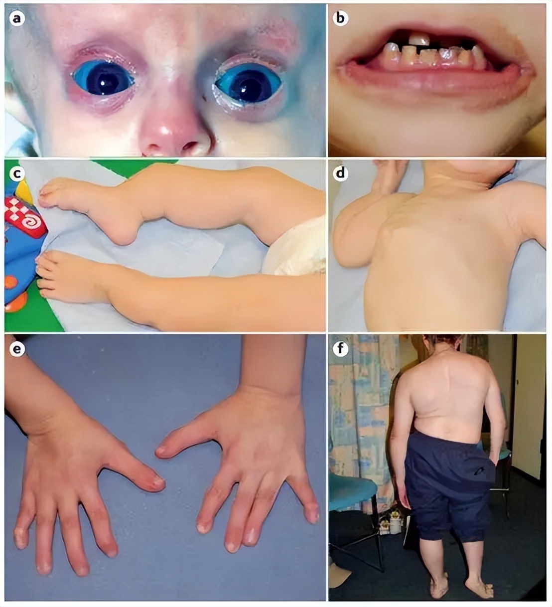 骨折30年被人当“*子骗**”，只因帮深圳这香港医生说了一句话