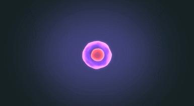 慢性肾病5期猝死,慢性肾病最终消息