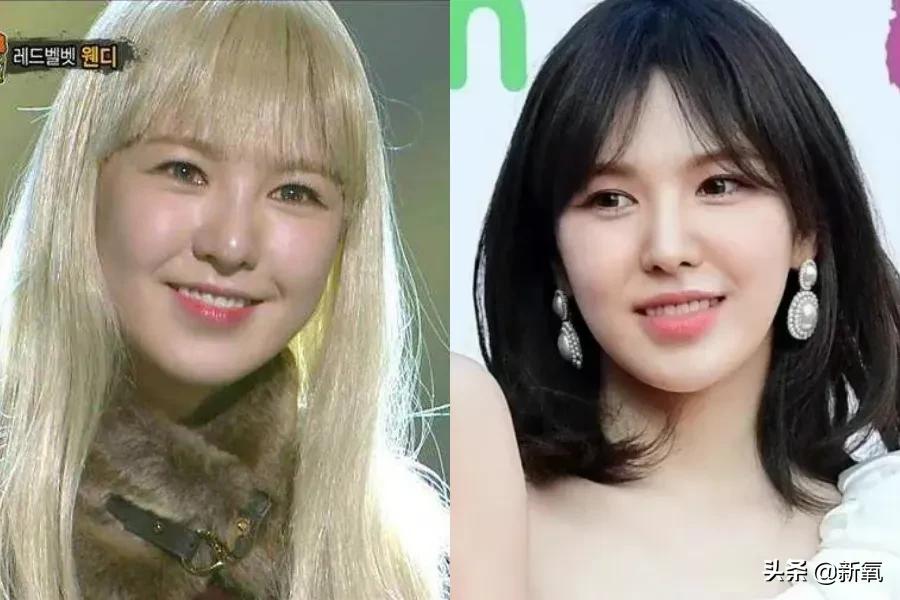 做什么医美项目皮肤立刻变好,为什么脸做了很多项目还是不好看