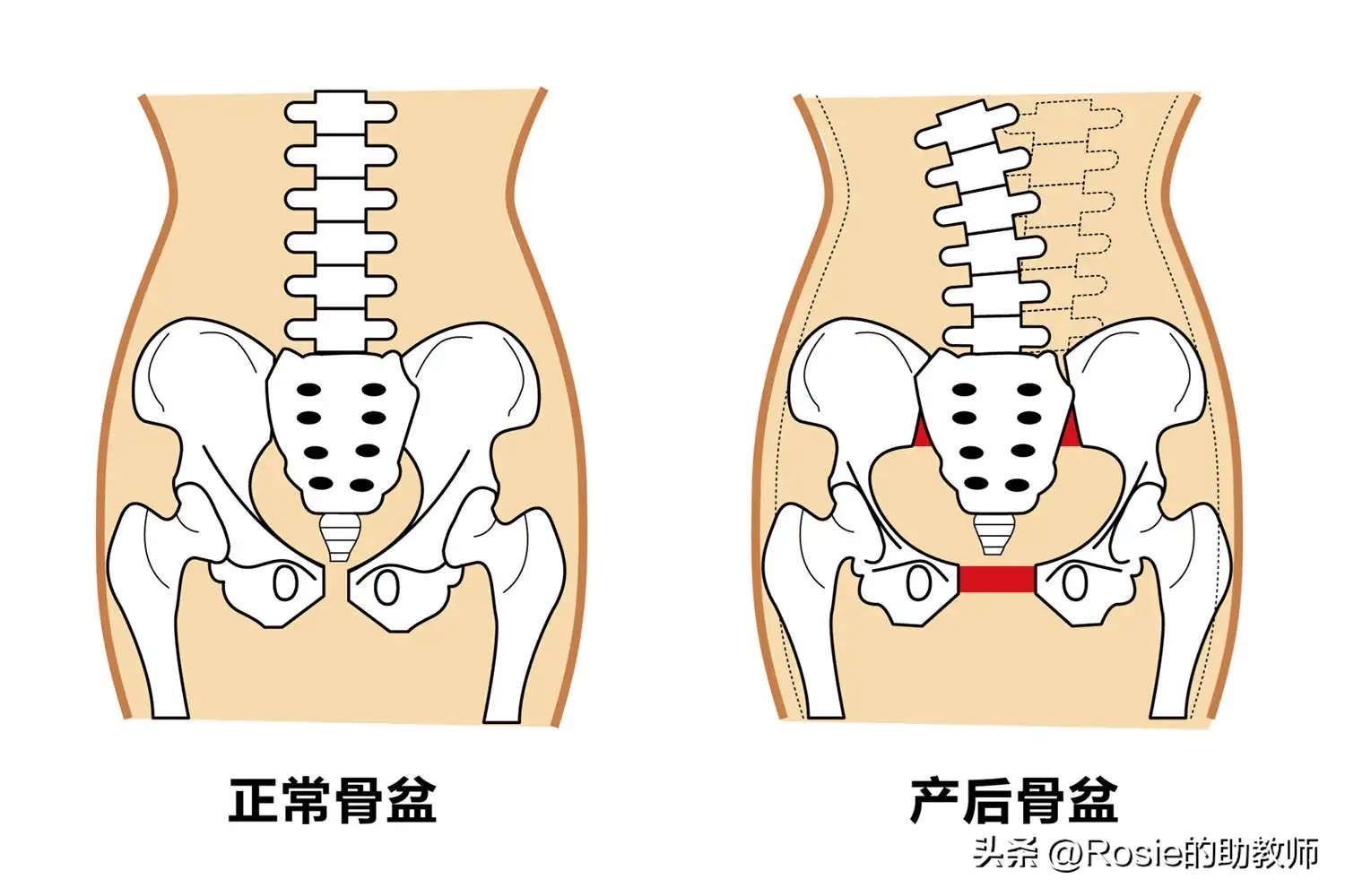 戚薇挺孕肚出行辣妈范儿，产后身体变化有哪些？三步赶走粗腰肥臀