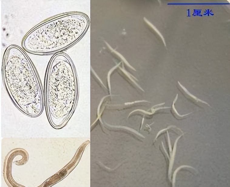 宝宝总是抠屁屁家长要警惕这种病,宝宝屁屁有蛲虫用什么