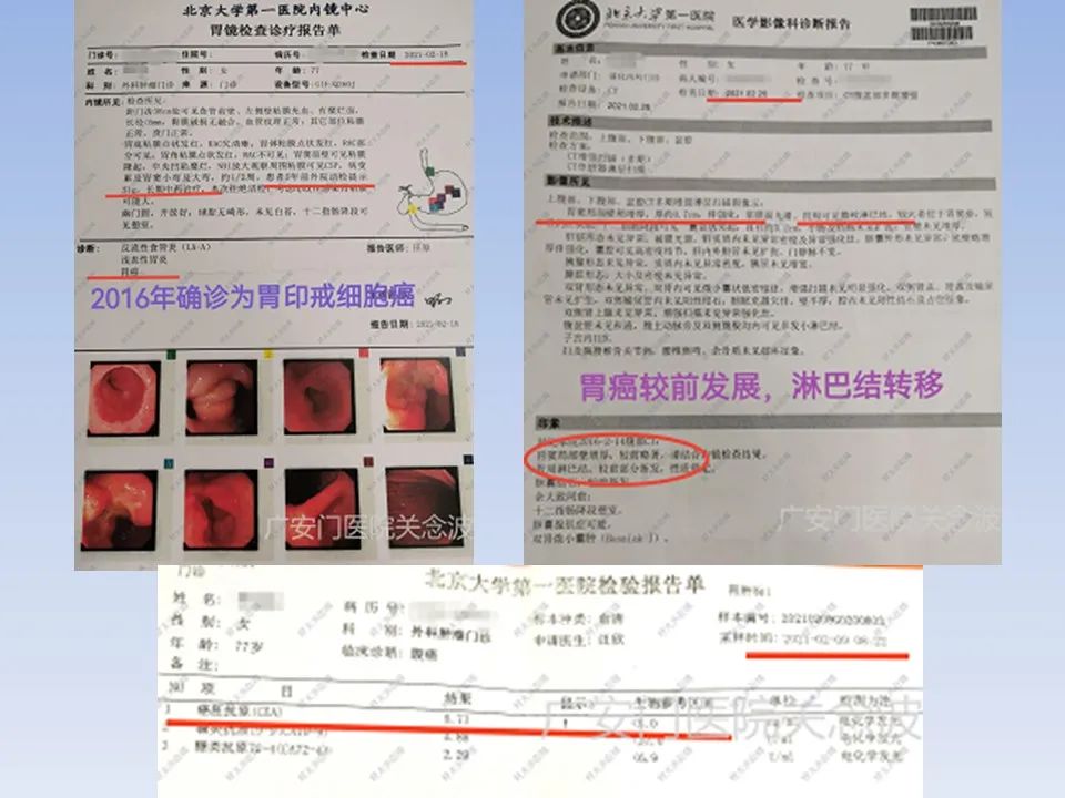 正确使用中医药治疗肿瘤才显效,关于中医中药在肿瘤治疗中的见解