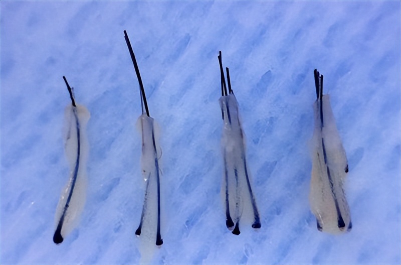 连明星都逃脱不了的高发际线时尚,雄秃现状