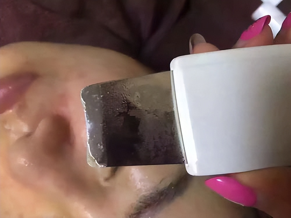 超微小气泡美容有用吗,美容院小气泡