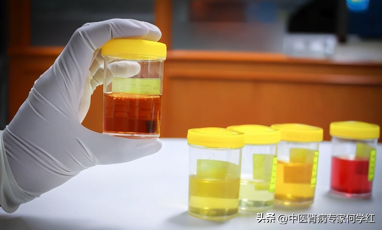 肌酐131肾功能损坏什么程度,肾功能轻度损坏是肾功能不全吗