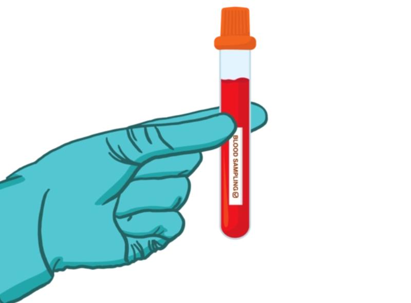 血常规中嗜酸性粒细胞升高要警惕,血热做血常规什么指标会升高