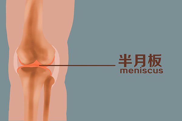 半月板撕裂疼痛怎么缓解,半月板三度撕裂怎么缓解疼痛