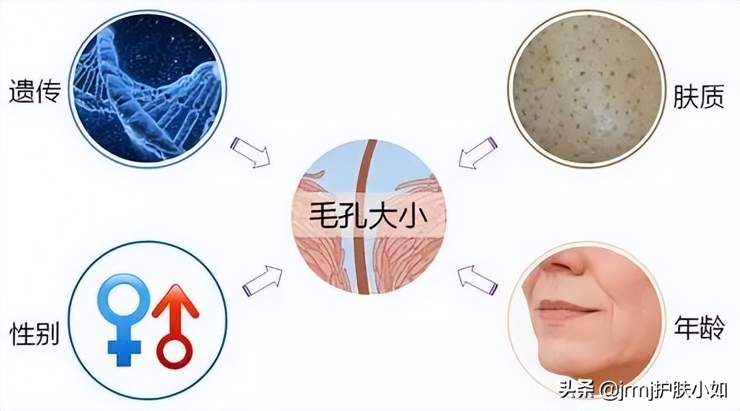 不靠任何手段改善痘痘,去黑头收缩毛孔最有效的医美