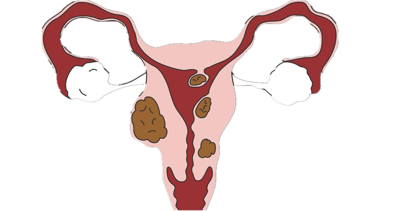 仅含3味中药，就能散尽各种结节、囊肿、肌瘤！效果很好，请收藏
