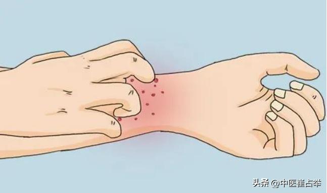 血虚血热血燥的症状,血虚血瘀血热血寒的症状