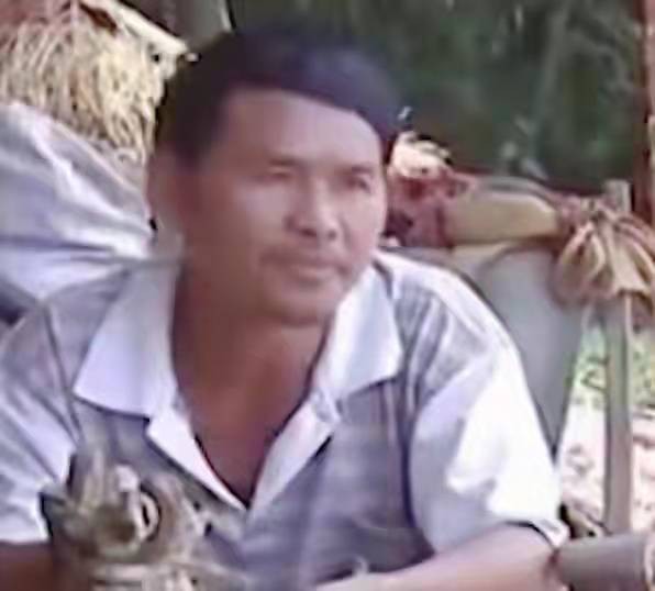 男子手长满树疙瘩是什么病,男子手长满树疙瘩手术了吗