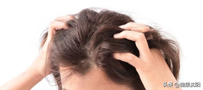 赶走头屑八个科学对策,头屑带来的烦恼是什么