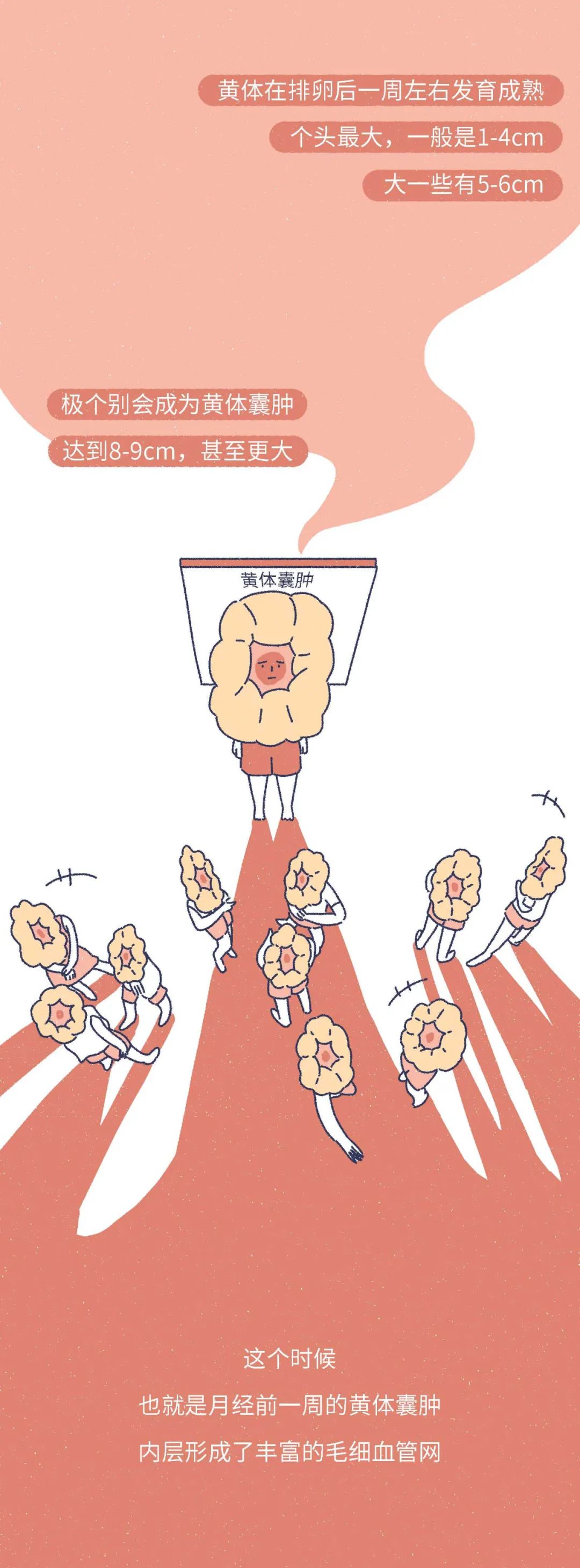 女生黄体破裂会是什么表现,什么原因会导致女性黄体破裂