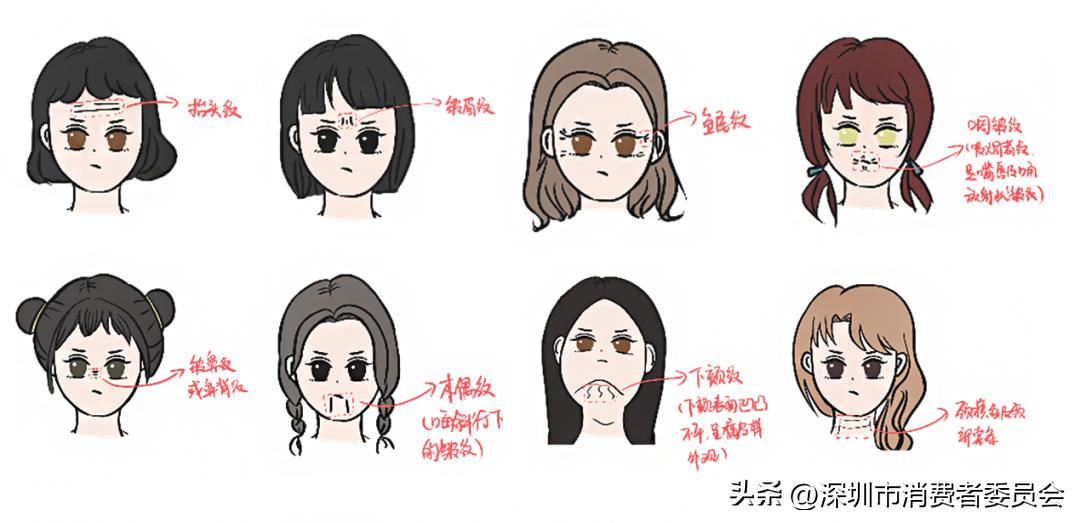 打完肉毒素以后不打会更显老吗,打完肉毒素皱纹变少了