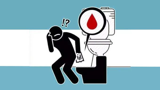 「医界趣闻」肛肠科那些事儿