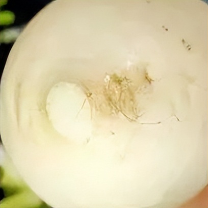 止咳清肺的食材,沙尘天气8大清肺润肺水果要多吃