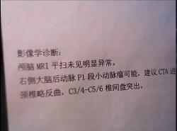 旭旭宝宝下半身肿瘤恶化,旭旭宝宝得了脑瘤