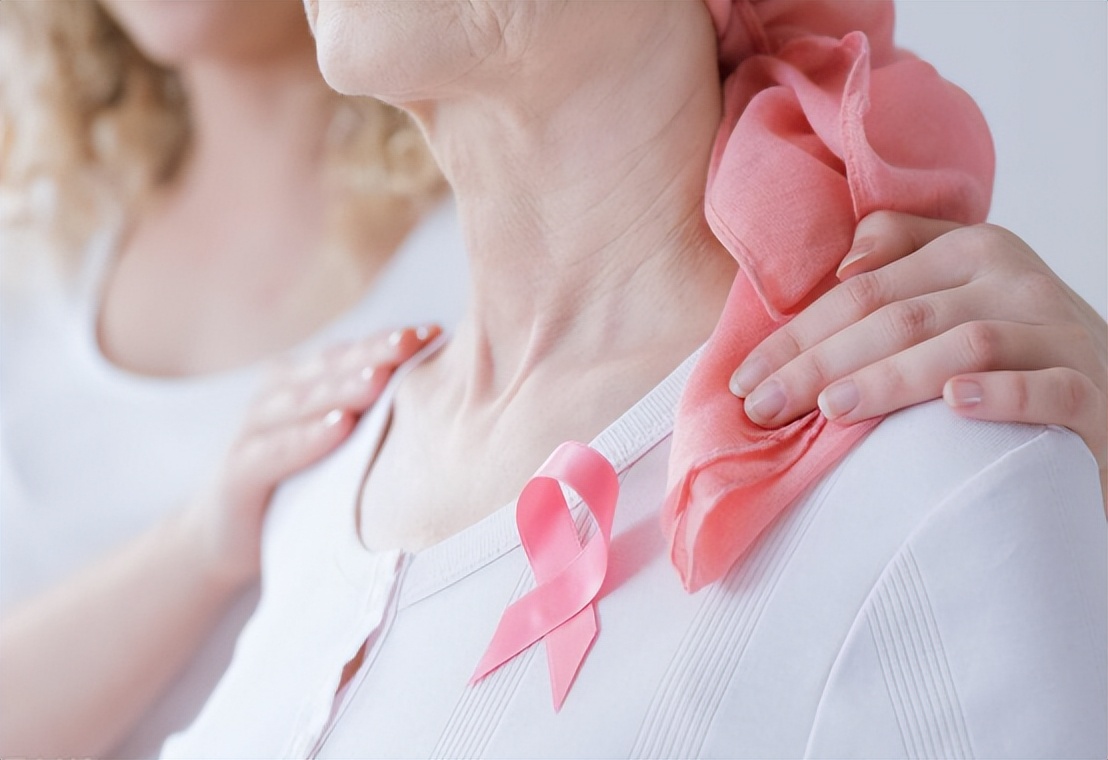 异时性双侧原发性乳腺癌10年,双侧原发性乳腺癌需要化疗吗